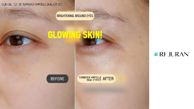 REJURAN 麗珠蘭 韓國 逆齡再生核心活膚面霜 50ml