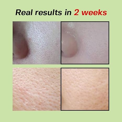 SUNGBOON EDITOR Green Tomato Pore Firming Essence 30ml + 30ml