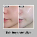 Crème blanchissante Medipeel Bio Intense au glutathion 50 g