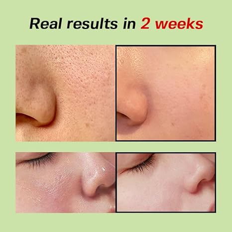 SUNGBOON EDITOR Green Tomato Pore Firming Essence 30ml + 30ml