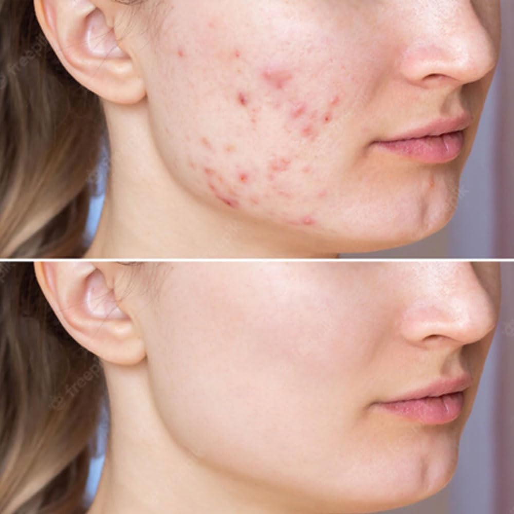 Care:Nel 5% Niacinamide Anti-Melasma Cica Cream 40ml