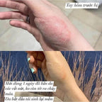 GC Biopharma 韓國 Nobason 快速緩解發炎乳膏 15g