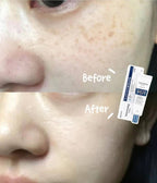 Dong a Pharm MelaToning Cream 30g