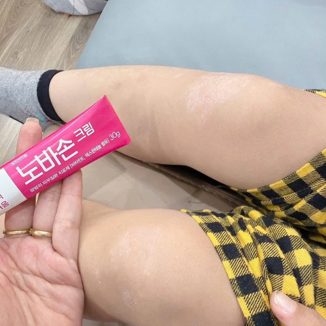 GC Biopharma Nobason Cream (Treatment for a wide range of skin diseases) 15g