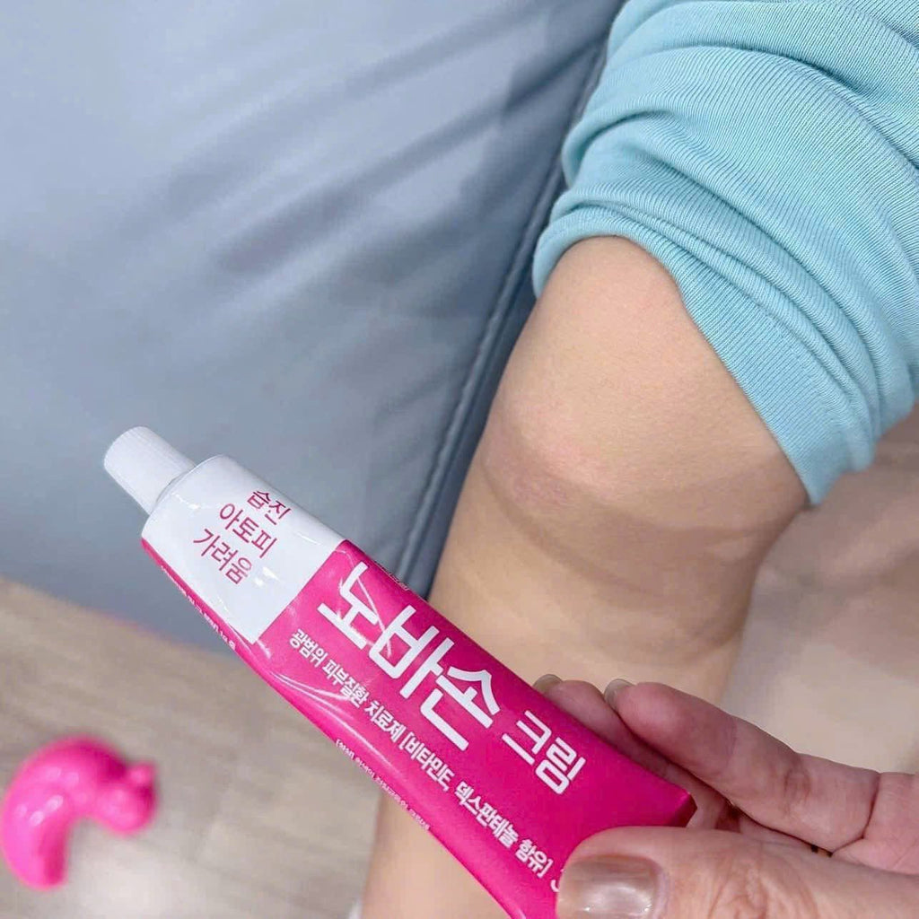 GC Biopharma 韓國 Nobason 快速緩解發炎乳膏 15g