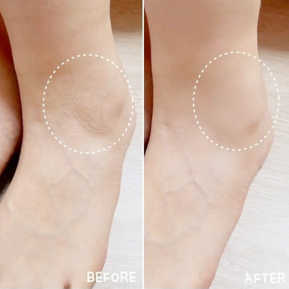 kwangdong Dancua Heeling Peeling Cream 50g