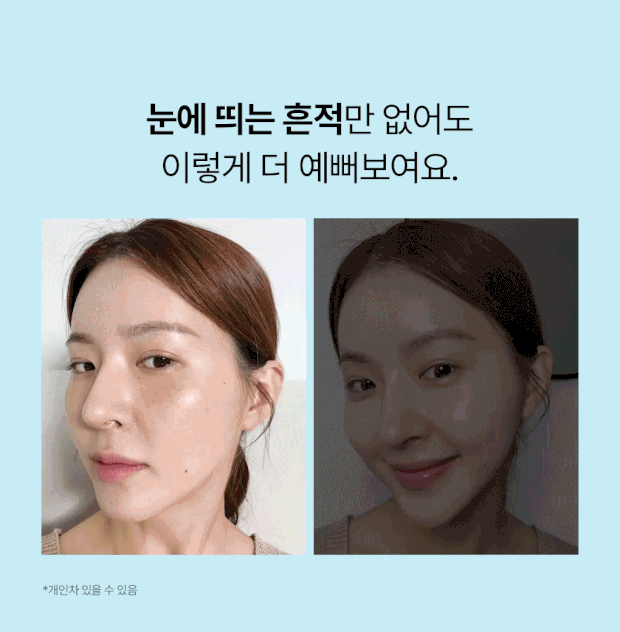 Mediheal 20612 Madecassoside Blemish Repair Serum (Calming) 40ml