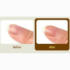 Medipeel Rx Oriental 足部和指甲精華 17ml