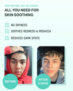 BRING GREEN Zinc Teca™ 1.2% Blemish Serum 25ml