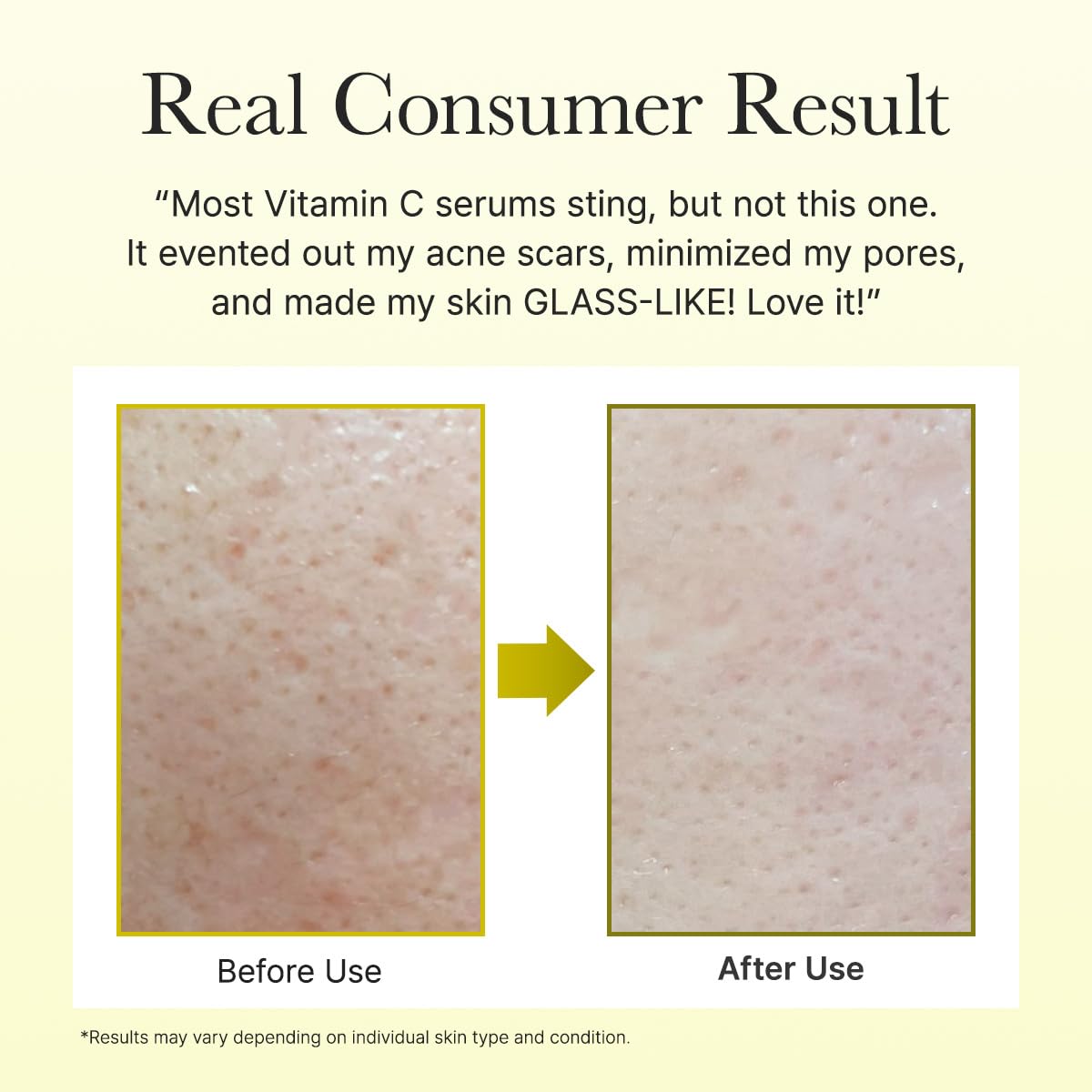 Arencia 5% Vitamin & Glutathione Vitamin C Booster Shot (Fades Dark Spots & Acne Scars) 30ml