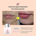 The YEON 速效去痘粉紅痘痘修復液 15ml