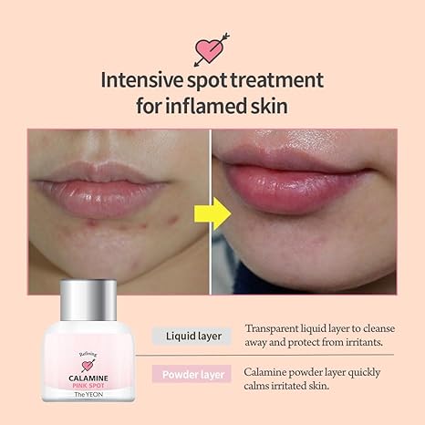 The YEON Refining Calamine Pink Spot 15ml