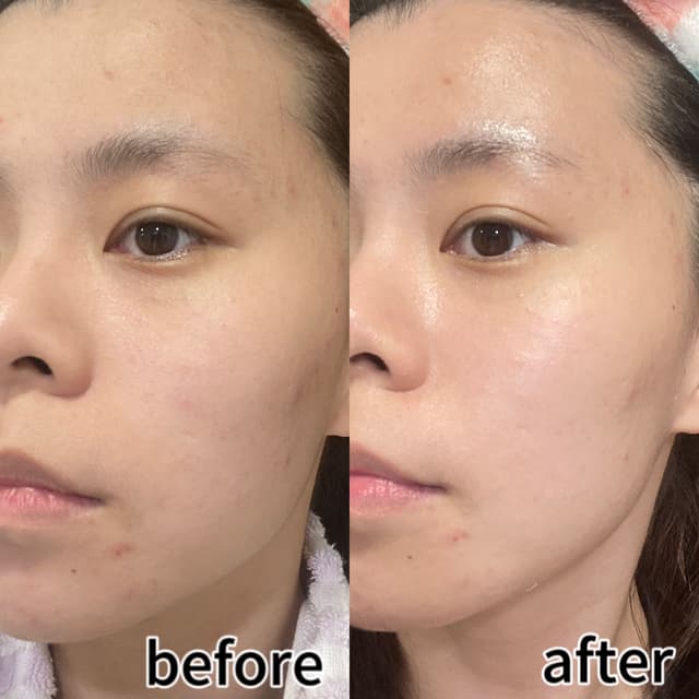 Medipeel 韓國 膠原蛋白抗皺爽膚水 1000ml