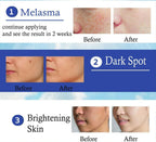 Yanhee Acne Cream 10g