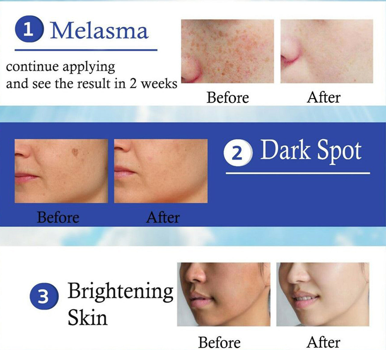 Yanhee Acne Cream 10g