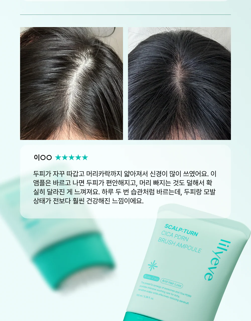 Lilyeve Scalp:Turn Cica PDRN Brush Ampoule 100ml