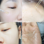 Ample N Acne Shot Ampoule 30ml