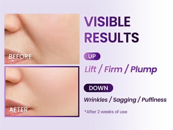 BOH Probioderm 3D Lifting Ampoule 30ml