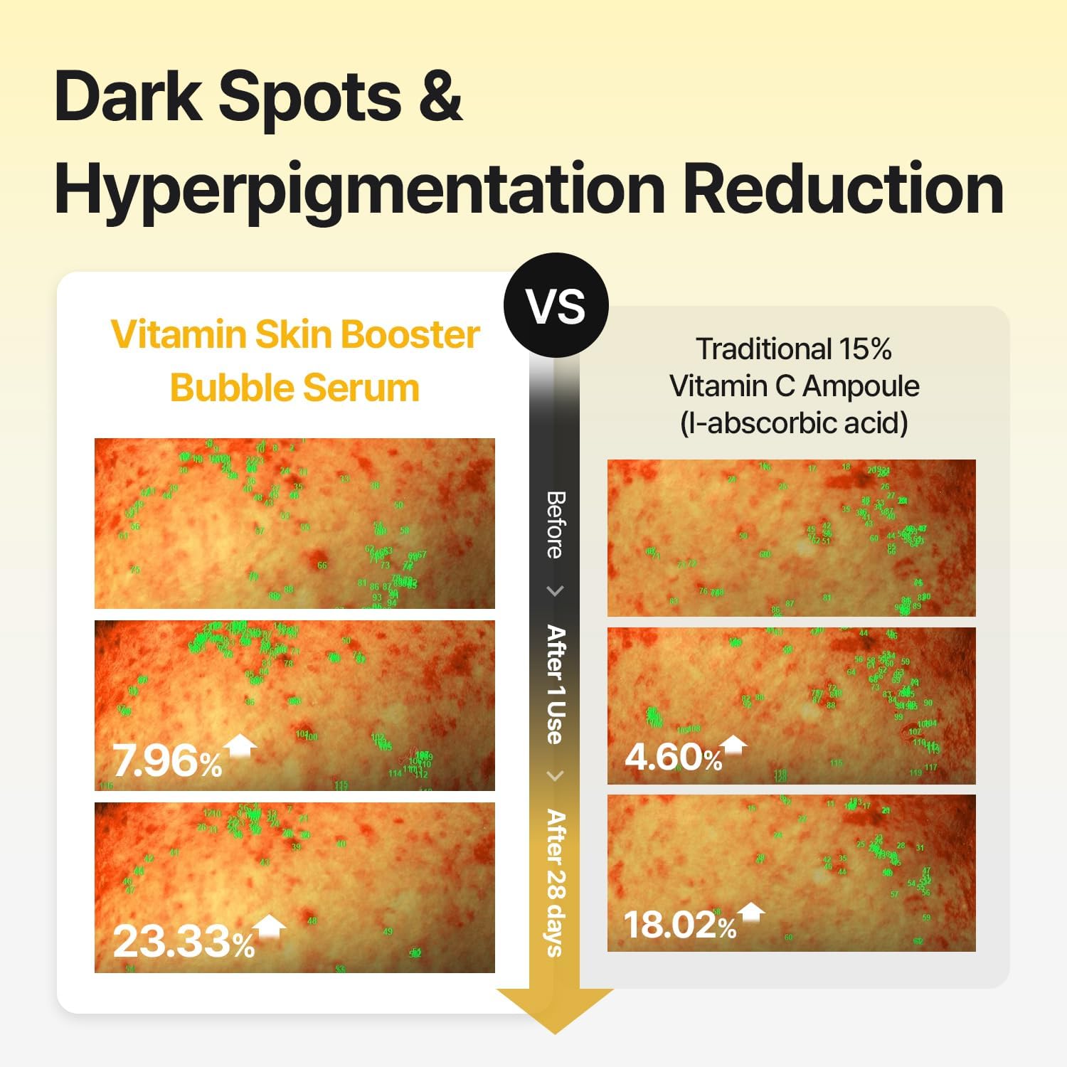 MEDITHERAPY Vitamin Glutathione Skin Booster Bubble Serum 100ml