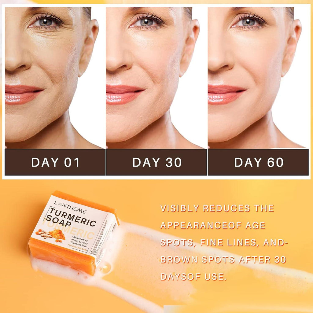 LANTHOME TURMERIC Remove Pimples Dark Spots SOAP 100g
