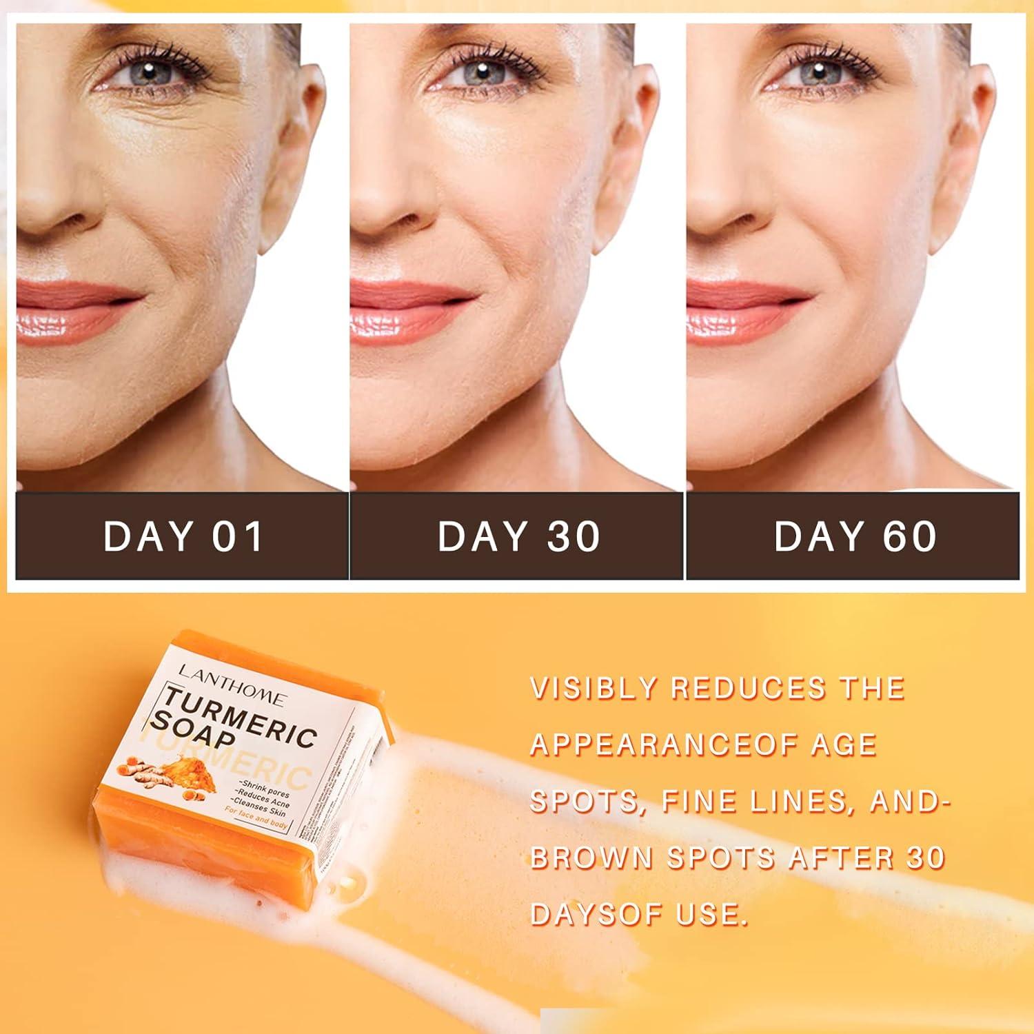 LANTHOME TURMERIC Remove Pimples Dark Spots SOAP 100g