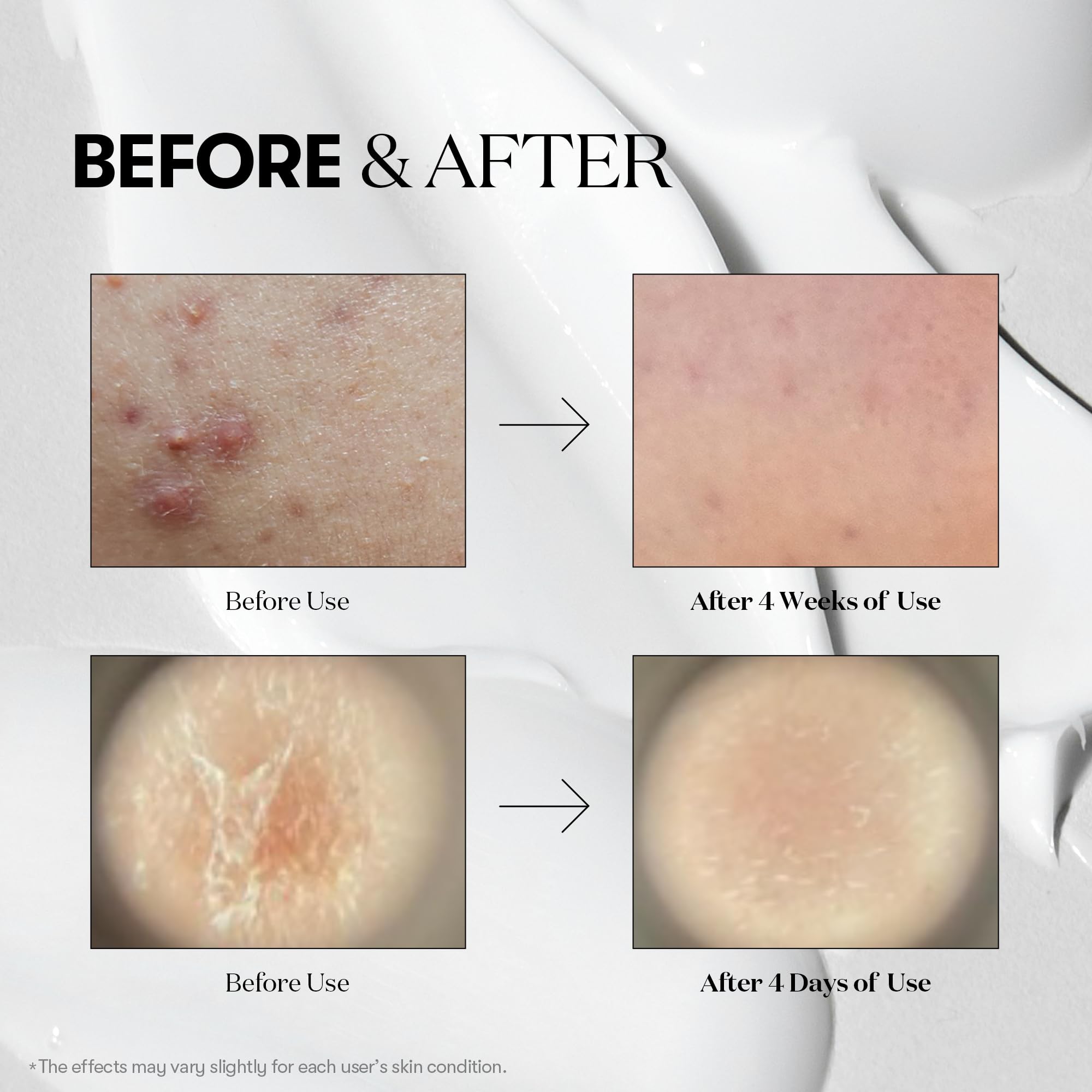 VT Reedle Essence Shot 700 30ml