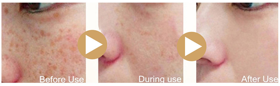 SAUVASINE 薑黃美白去斑精華油 30ml