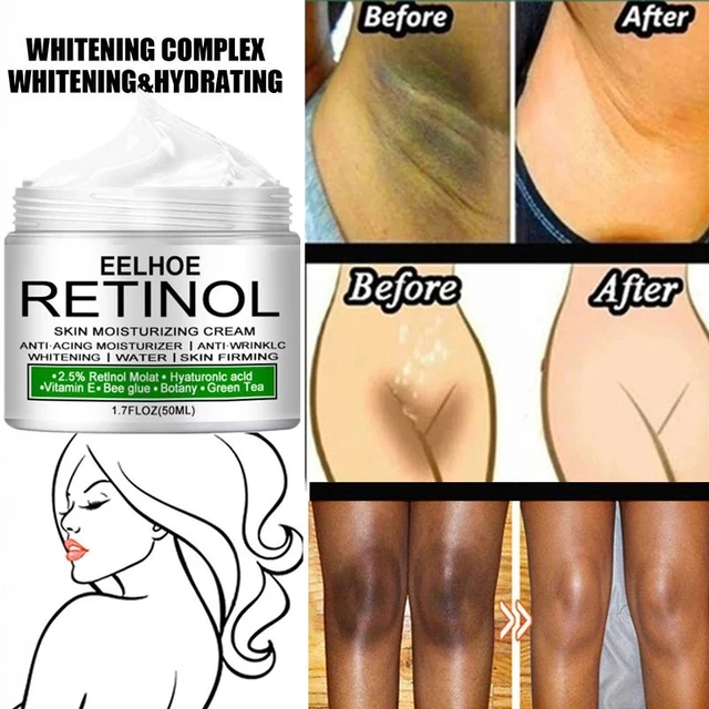 Eelhoe Retinol Skin Moisturizing Cream 50ml