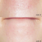 ilso Super Melting Sebum Softener Special Set 150ml (Toner + Cotton Pad 40pcs + Deep Clean Master)