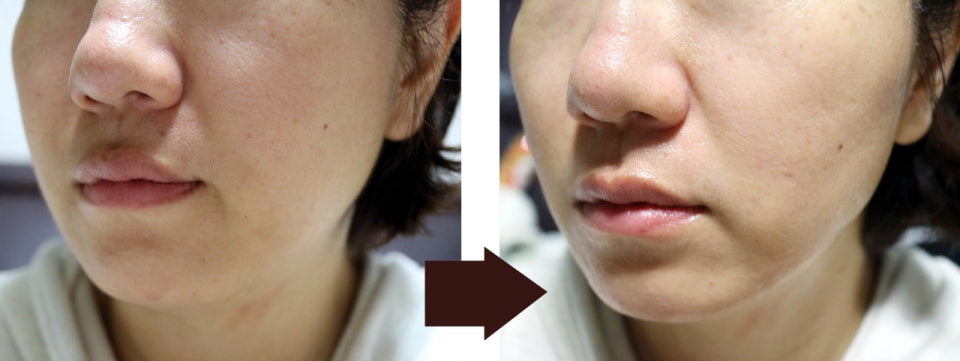 Goodal 韓國 青橘維他命 C 淡斑凝膠面膜 43g x 5片