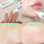 Dong-A Pharm 2% Salicylic Acid Aclean Gel 20g