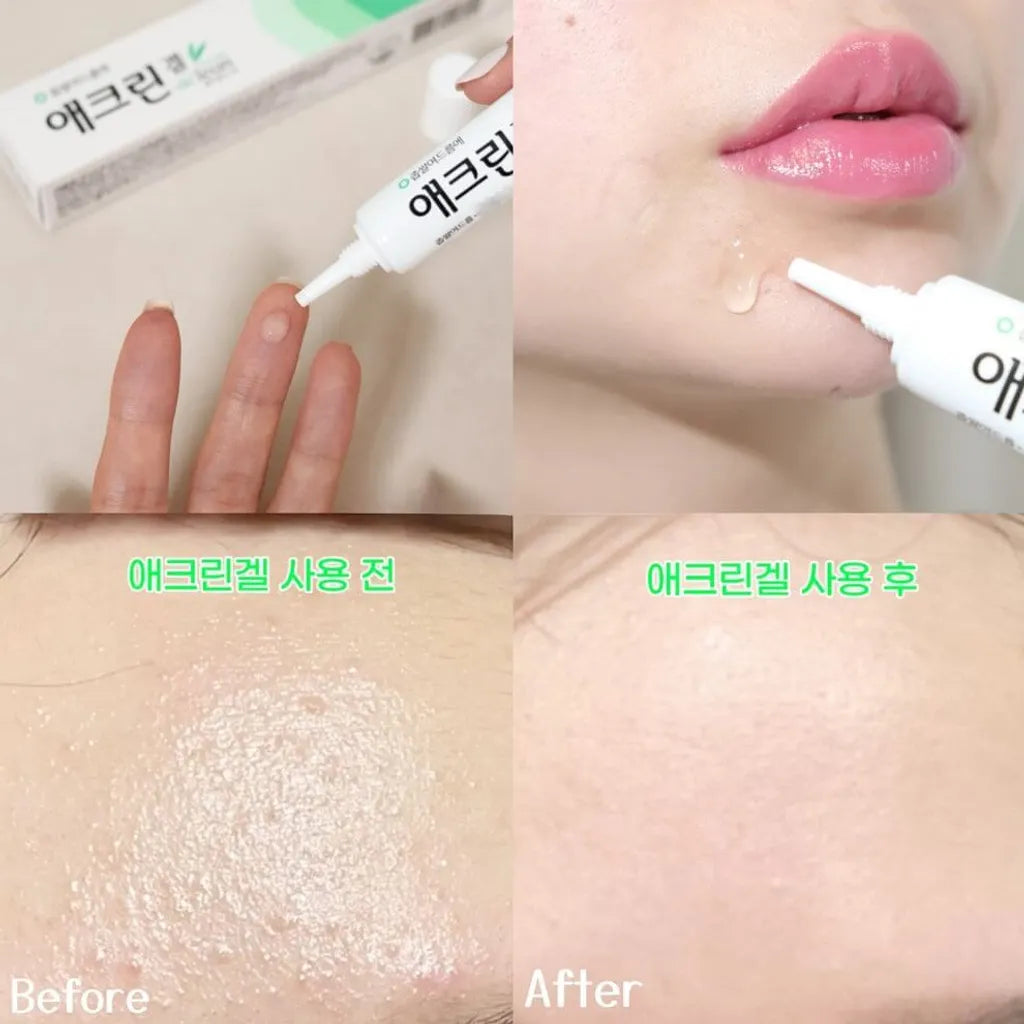 Dong-A Pharm 2% Salicylic Acid Aclean Gel 20g