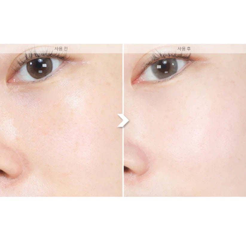 Sungboon Meoru Podo Vita C Dark Spot Ampoule 30ml