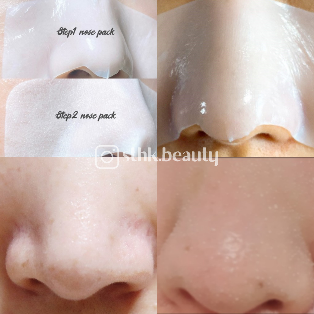 RNW Clear Nose Pack Blackhead Removal Pore Contraction 5sets
