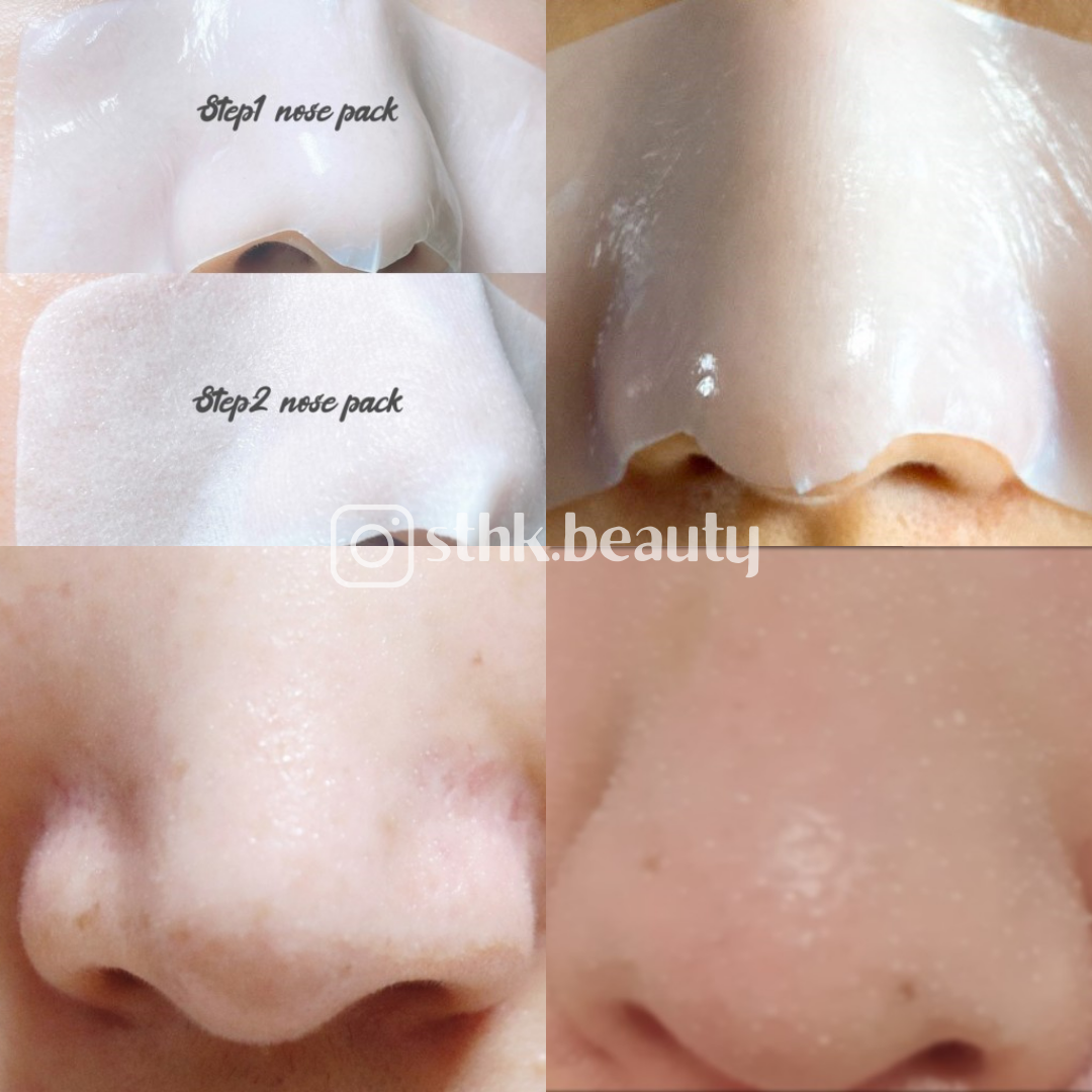 RNW Clear Nose Pack Blackhead Removal Pore Contraction 5sets