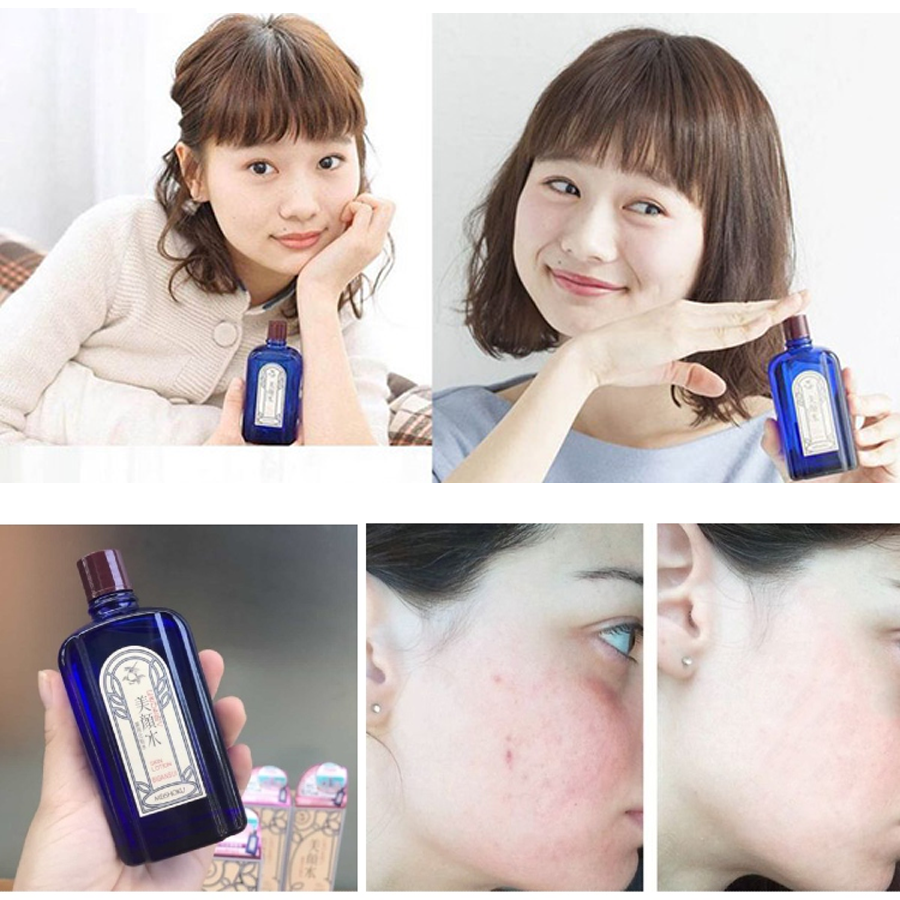 Meishoku Medicated Skin Lotion 90ml