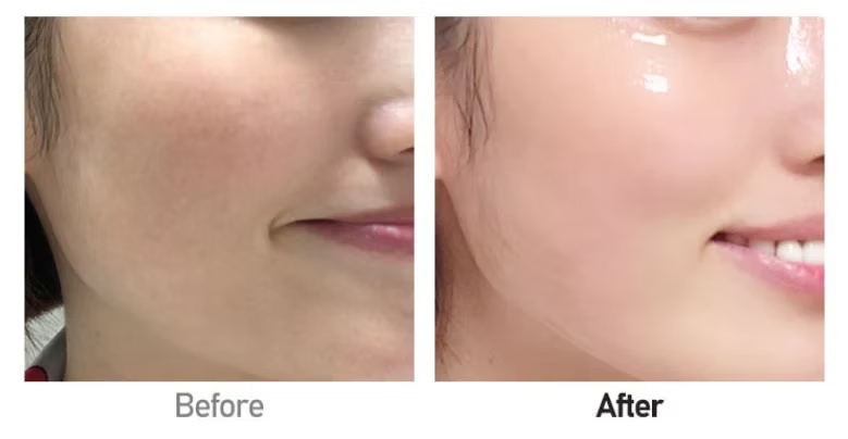 Medipeel 韓國 膠原蛋白抗皺爽膚水 1000ml