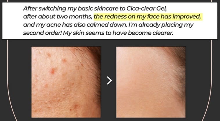 Dr.Blanc Cica Clear Gel 30ml