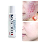 CLINDA M Acne Water 15ml