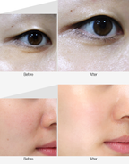 Medipeel Mezzo Filla Eye Serum 30ml