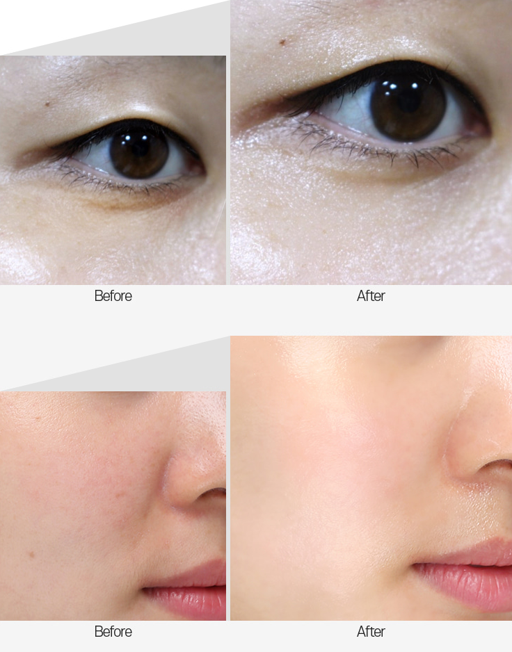 Medipeel Mezzo Filla Eye Serum 30ml