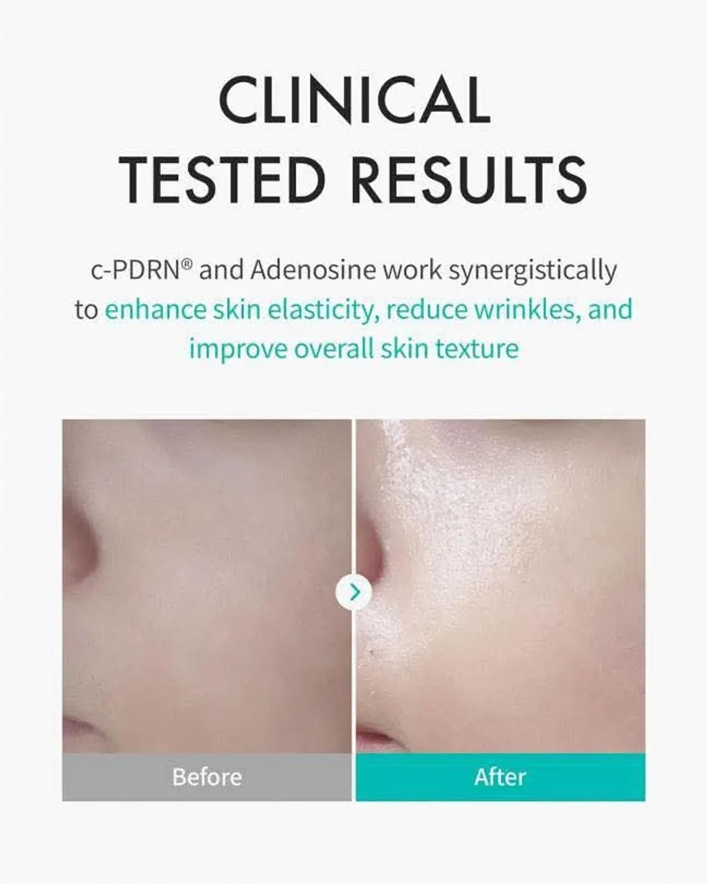 Rejuran 麗珠蘭 韓國 菁萃強效修護面膜 5片