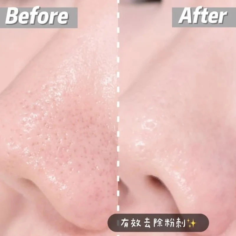 Dong-A Pharm Aclean Gel 20g