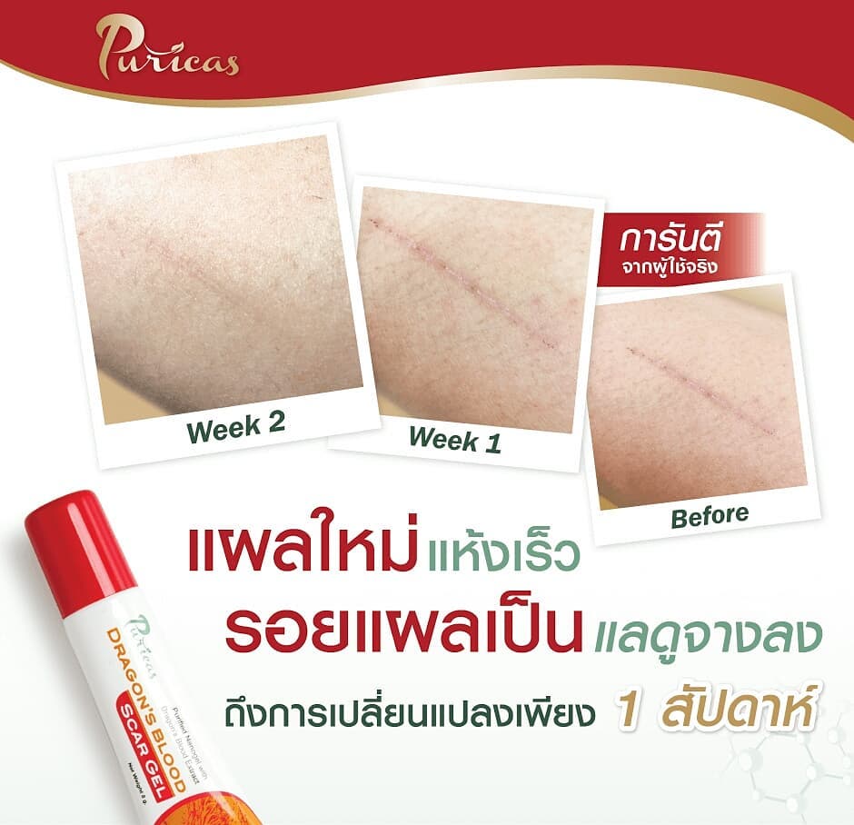 Puricas Dragon's Blood Centella Asiatica Scar Gel 8g