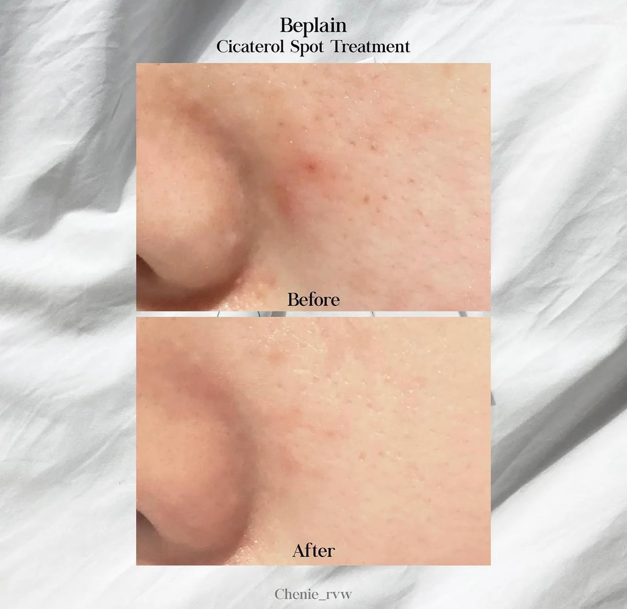 Beplain Cicaterol Panthenol Capsule Barrier Cream 50ml