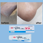 Hanmi 韓國 PRO-CALM 強效醫美手腳裂膏 50g