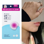 Patchs anti-cicatrices Olive Young Care Plus (Renouvellement du design) 324 unités