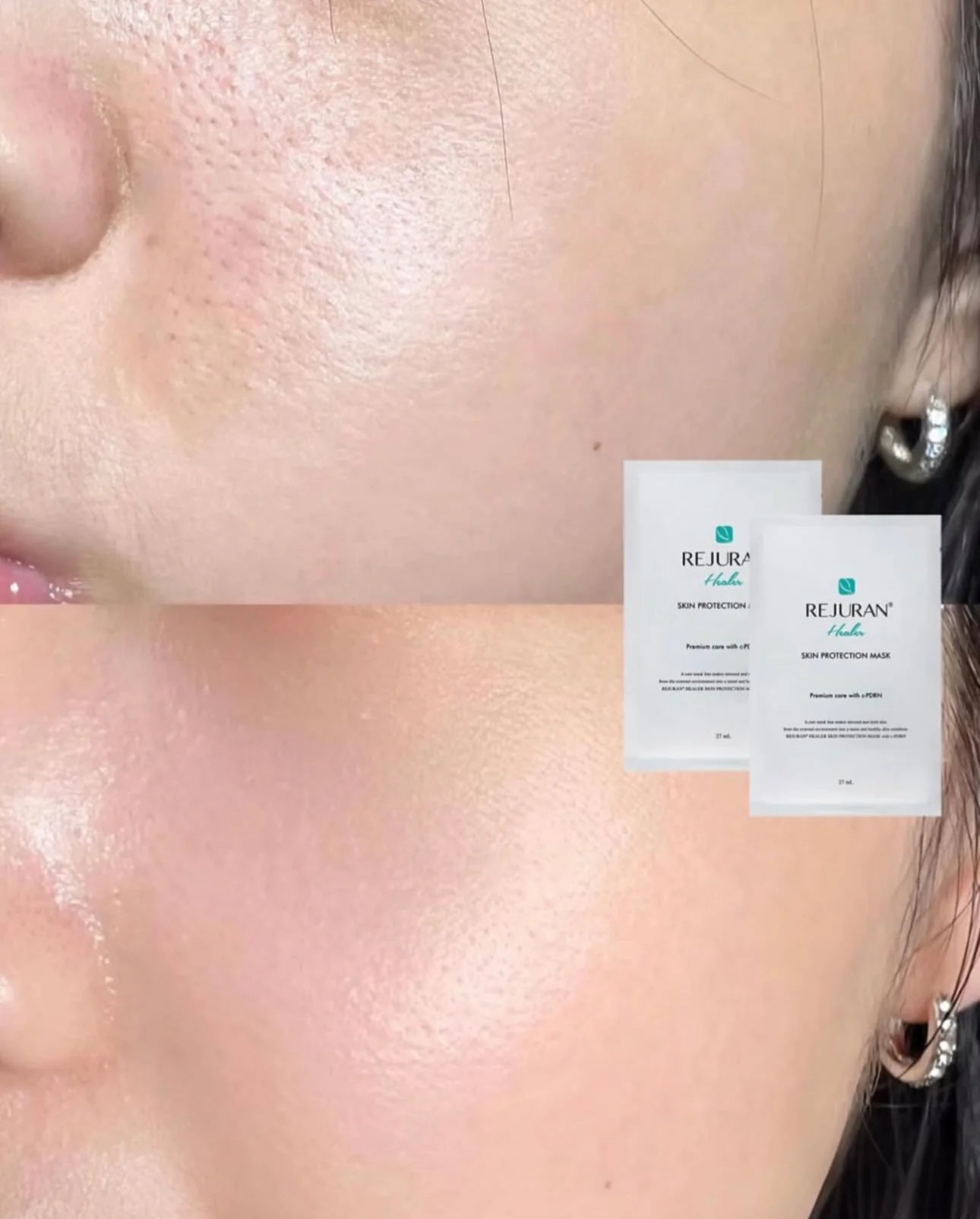 REJURAN Healer Skin Protection Mask 5 packs / box