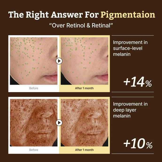 Dr. Reju-All EP4 Advanced Retino-Mela Tone Cream 30ml