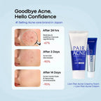 PAIR Acne Creamy Foam Facial Washing Foam 80g